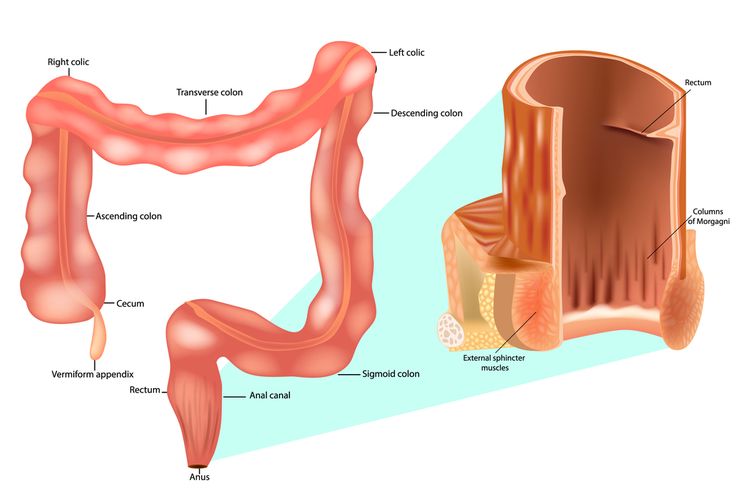 Penyebab Abses Anus: Memahami Masalah Kesehatan yang Perlu Diperhatikan